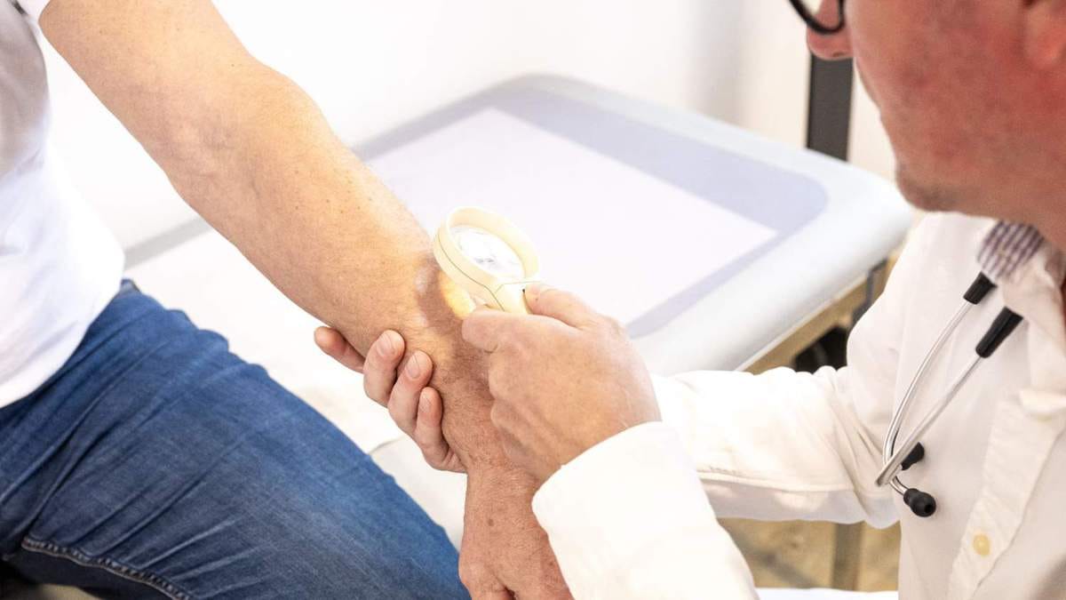 البقع الصبغية عند المرأة.. أسباب وكيفية التخلص منها